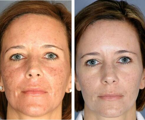 Pred in po delni termolizi obraza